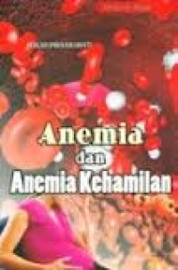 Anemia Masalah Gizi pada Remaja Wanita