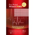 Cara Mudah Membaca EKG