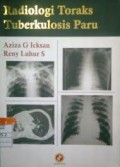 Radiologi Toraks Tuberkulosis Paru